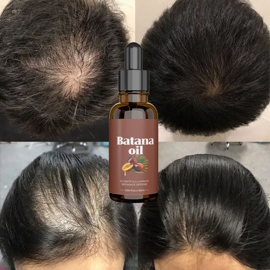 Organic Moisturizing 100% Pure Batana Oil Hair Growth Repair Nourishing Hair Oil Organic Moisturizing 100% Pure Batana Oil Hair Growth Repair Nourishing Hair Oil